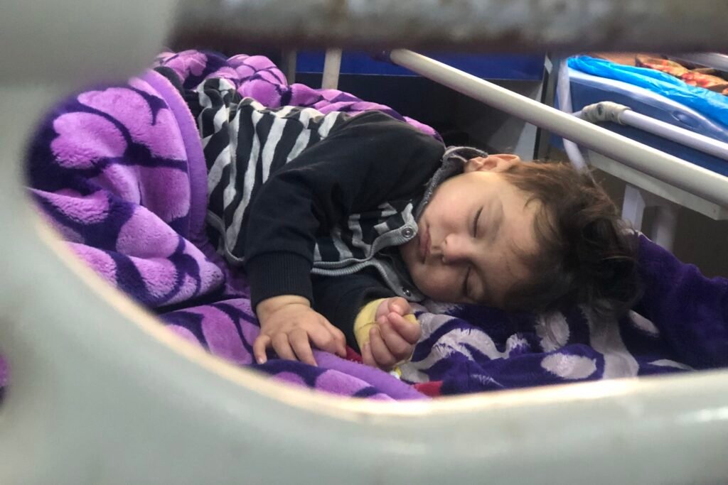 اطفال مصابون بمرض الحصبة